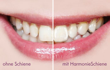 mitund ohne Schiene.indd